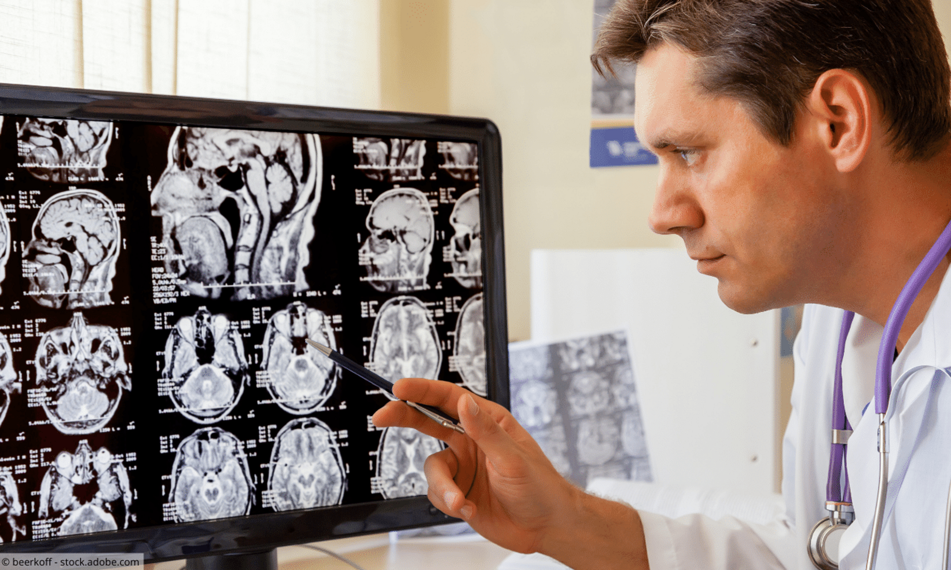 Arzt zeigt mit Stift auf Bildschirm mit Gehirn-Scans